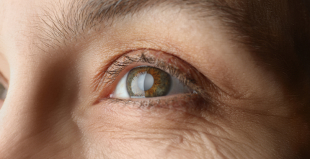 Cegueira e deficiência visual aumentam a nível mundial devido às cataratas