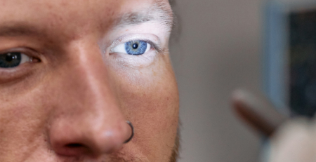 Oftalmologistas alertam para cancro associado ao olho