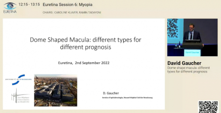 Atualização de conceitos relacionados com mácula em cúpula