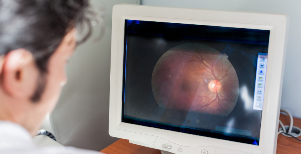 Iniciado ensaio clínico pioneiro com terapia celular para tratar doenças hereditárias da retina