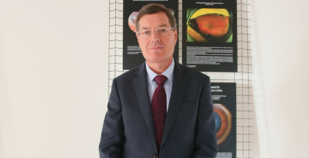 Flaps defeituosos: complicação de relevo em cirurgia refrativa