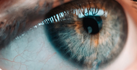 Oclusão vascular retiniana nos doentes com COVID-19