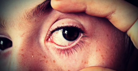 ESA e ISA organizam webinar internacional sobre cirurgia no estrabismo