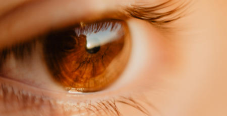 "O melanoma pode aparecer no olho, tal como na pele", alerta a SPO